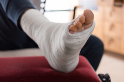 Definition and Symptoms of a Lisfranc Foot Fracture